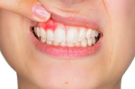 Many-Things-You-Can-Do-to-Prevent-Tooth-Loss.jpg