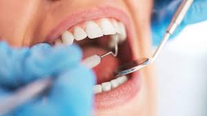 Affordable-Teeth-Cleaning-service-in-California.jpg