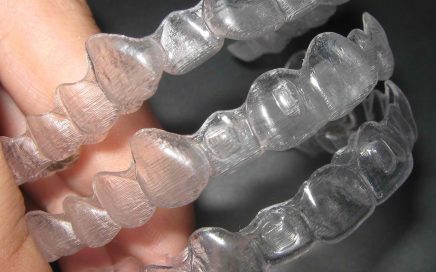 How-Invisalign-is-Made.jpg
