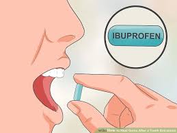 How-to-Speed-Up-Healing-after-Tooth-Extraction.jpg