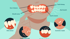 Signs-of-Dental-Problems.png